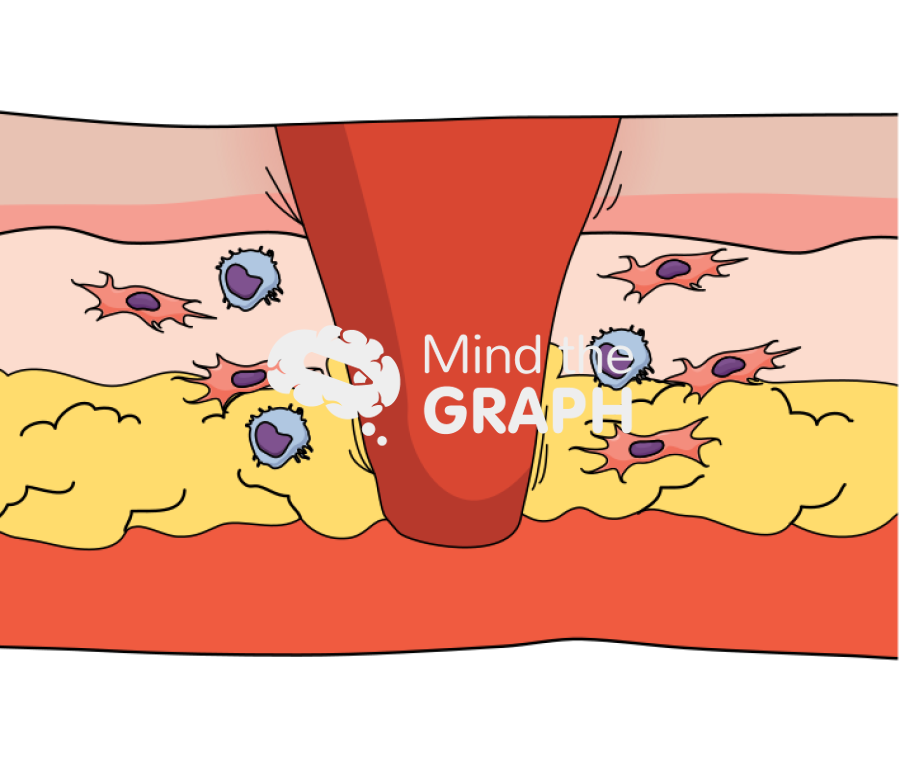 Wound healing inflammation longitudinal cut Icons, Symbols, Pictures, and Images