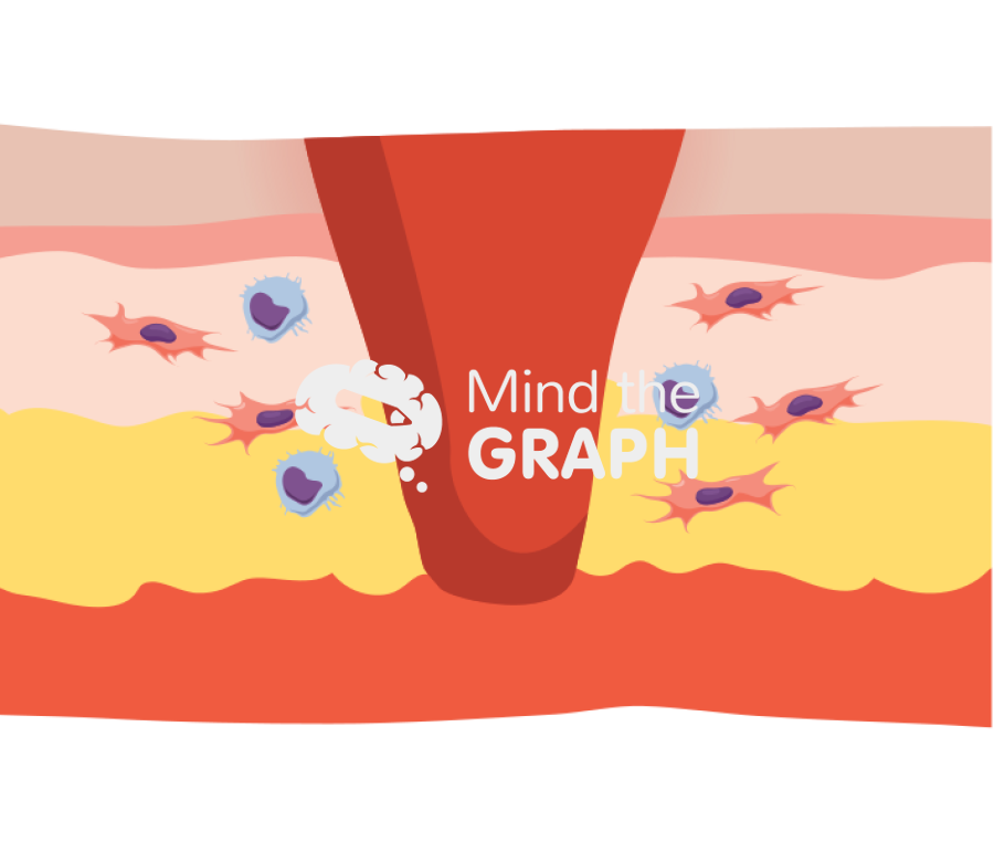 Wound healing inflammation longitudinal cut Icons, Symbols, Pictures, and Images