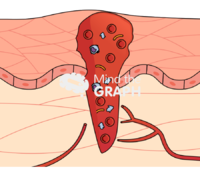 Wound healing process 1 Icons, Symbols, Pictures, and Images