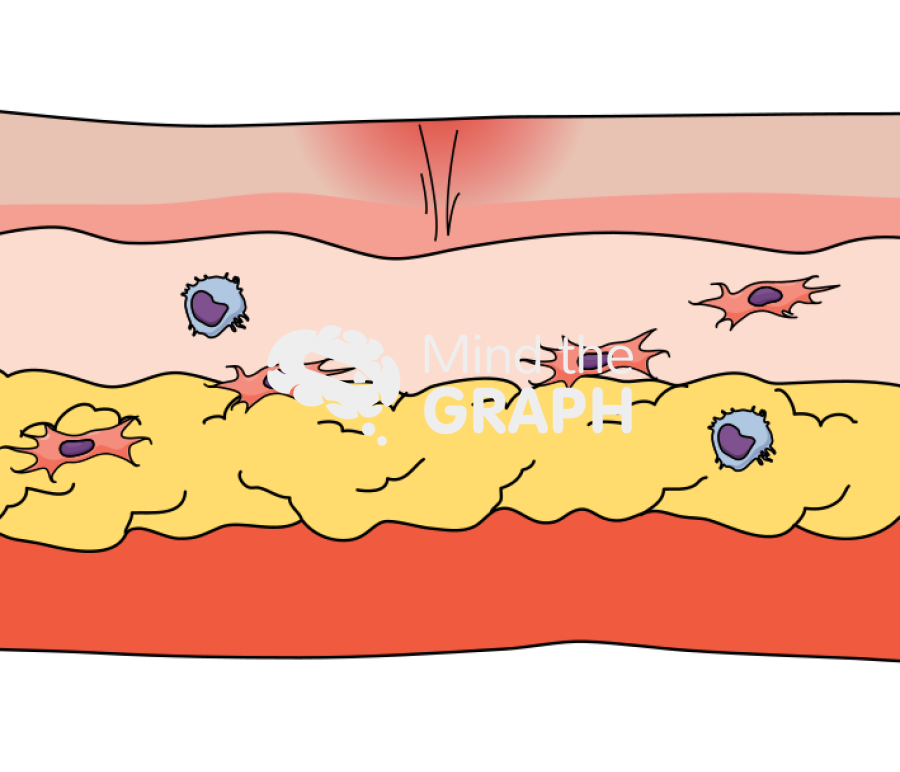 Wound healing remodeling longitudinal cut Icons, Symbols, Pictures, and Images