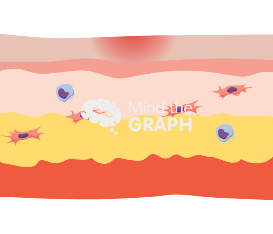 Wound healing remodeling longitudinal cut Icons, Symbols, Pictures, and Images