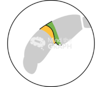 Zebrafish larvae mhb zoom Icons, Symbols, Pictures, and Images